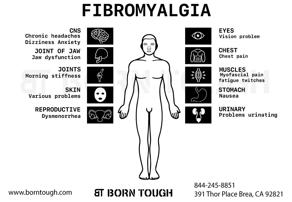 Fibromyalgia