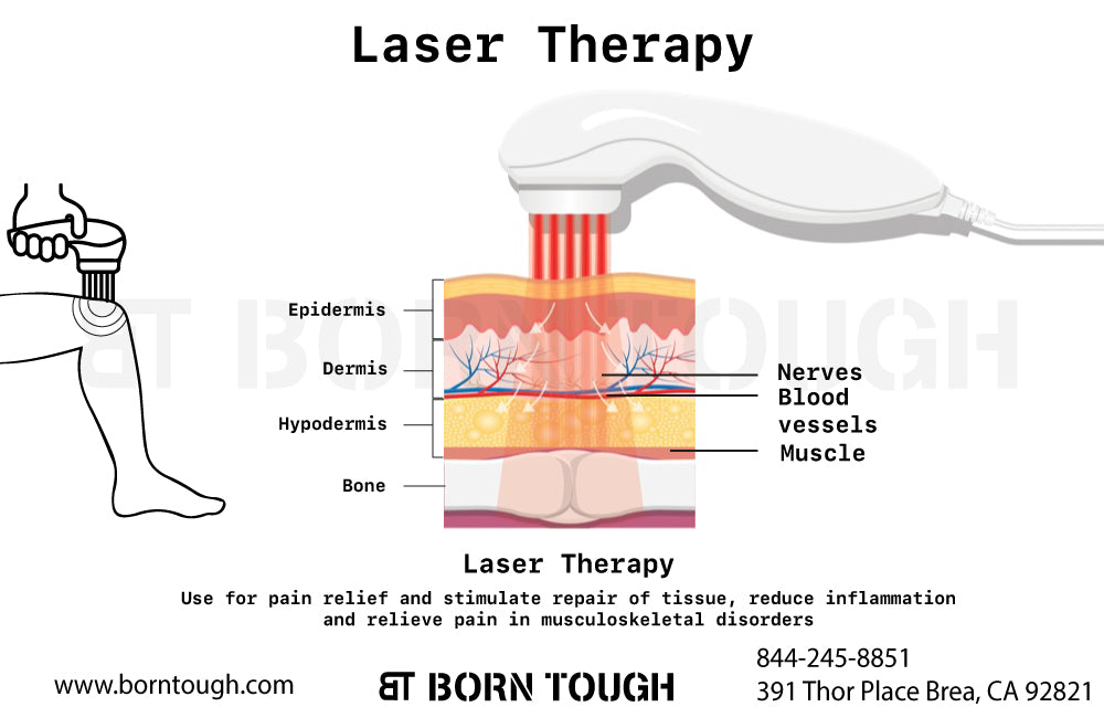 Laser Therapy