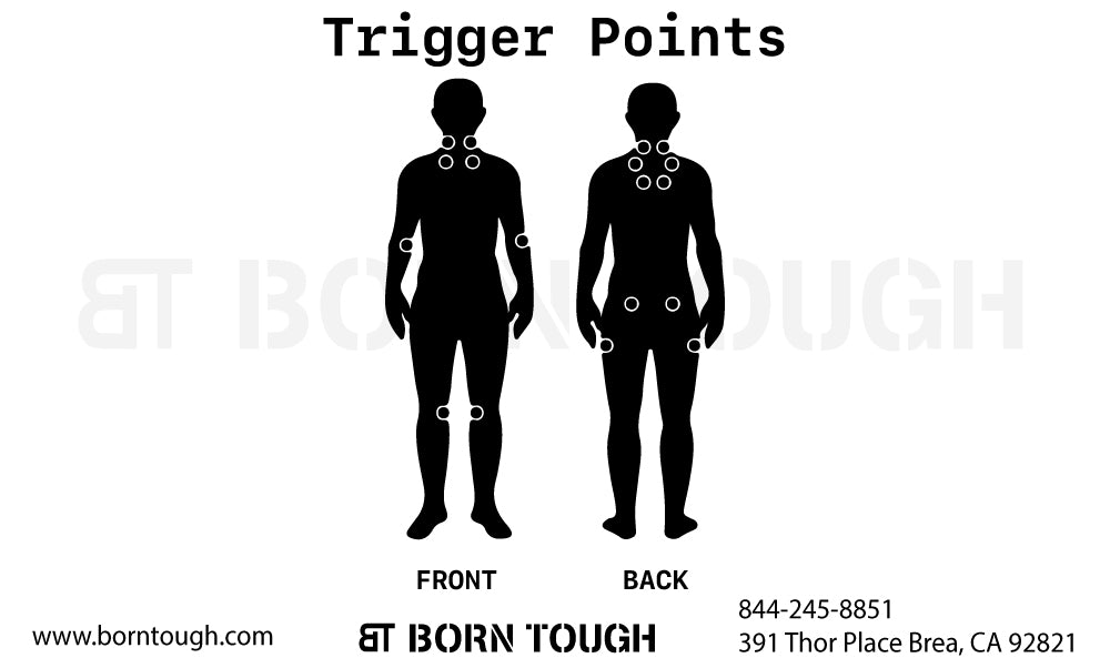 Where Do Muscle Knots Develop